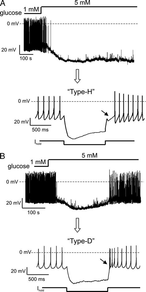 Adaptive And Nonadaptive Glucose Sensors Among Orexin Neurons A