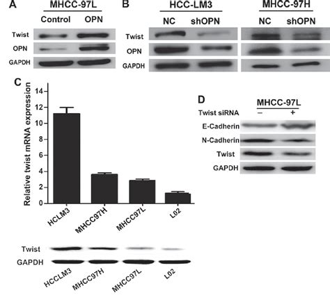 Figure 1 From Osteopontin Promotes Hepatocellular Carcinoma Progression Via The Pi3kakttwist