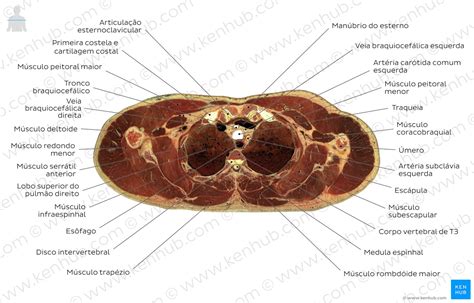 Cortes Transversais - Anatomia seccional: Secções transversais do corpo humano | Kenhub
