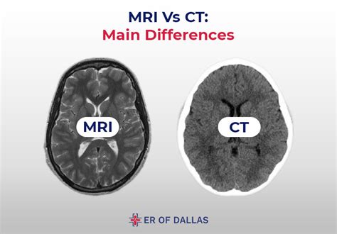 MRI vs CT Scan - Making The Right Choice - ER of Dallas