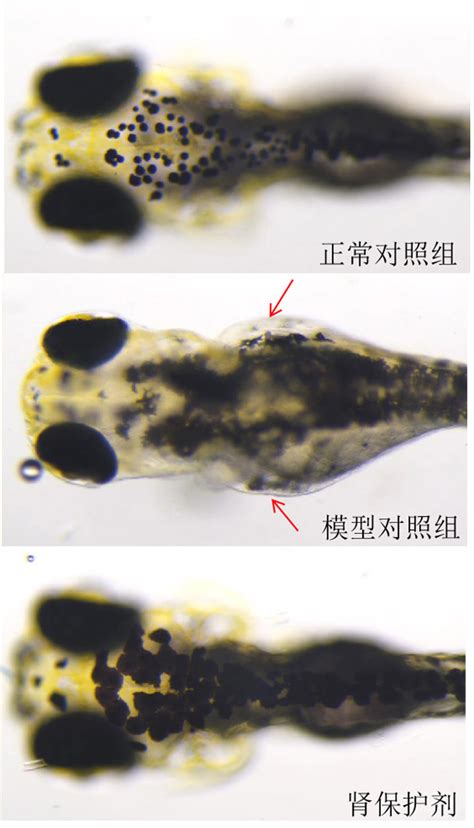 利用斑马鱼模型评价保护肾脏功效 肝肾疾病 环特生物丨健康美丽产业cro服务引领者丨斑马鱼 类器官 小鼠 人体