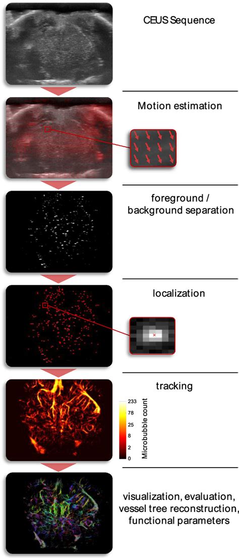 Figure 4 From Ultrasound Localization Microscopy Semantic Scholar