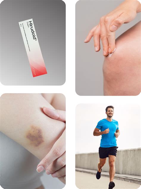 Hirudoid Cream Gel For Bruises And Scars Hiruscar Singapore