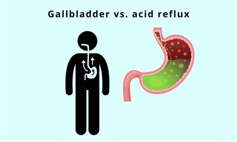 Sulfur Burps And Gallbladder Possible Underlying Conditions Causing