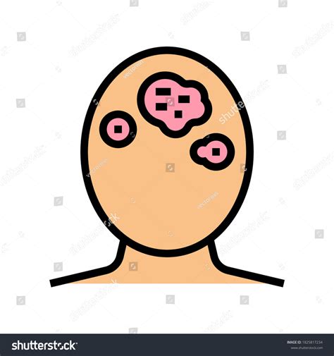 Seborrhoeic Dermatitis Skin Disease Color Icon Stock Vector (Royalty