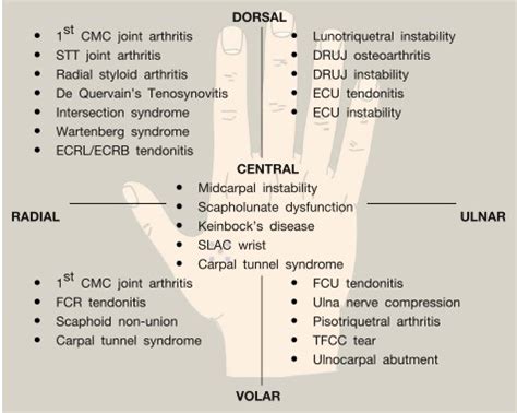 Differential Diagnosis of Radial-Side Wrist Pain [+FREE EBOOK] - ReHand ...