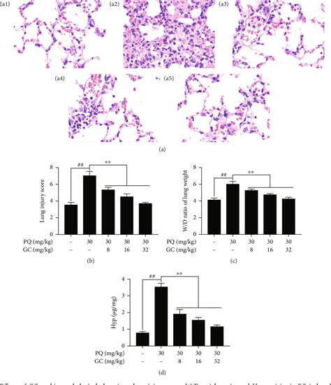 Figure From Ginkgolide C Alleviates Acute Lung Injury Caused By