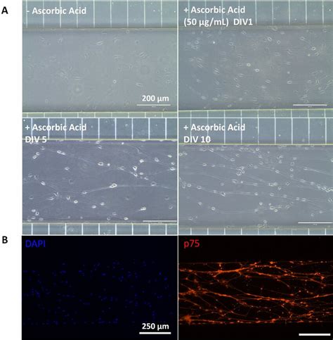 Induction Of Primary Rat Schwann Cells Towards A Myelinating Phenotype