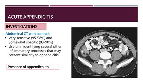 Acute Appendicitis Anatomy Aetiology Types Clinical Features Pptx