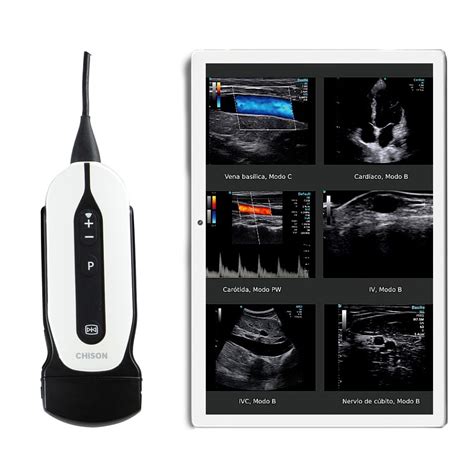 Ec Grafo Port Til Chison Sonoeye P Sonda Convexa Mhz Tablet De