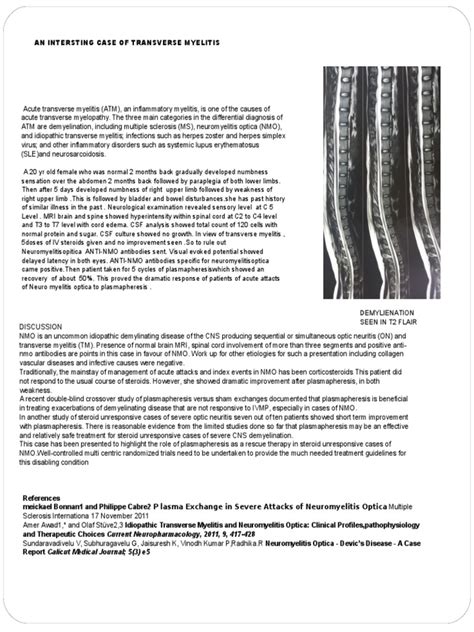 Neuromyelitis Optica | PDF | Neurology | Health Sciences