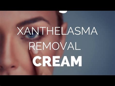 Xanthelasma removal cream, Xanthel, xanthelasma remover. - YouTube