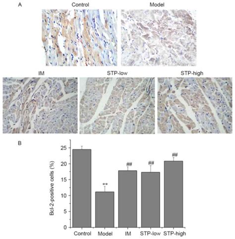 Protective Effects Of Shexiang Tongxin Dropping Pill On Pituitrin