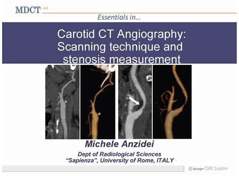 Carotid Ct Angiography Scanning Technique And Stenosis Measurement