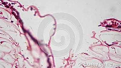 Polliondium of Funaria in Longitudinal Section Under Microscope 400x Against Bright Field Stock ...