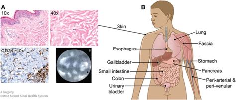 Interstitium Les Scientifiques Disent Qu Ils Ont D Couvert Un Nouvel