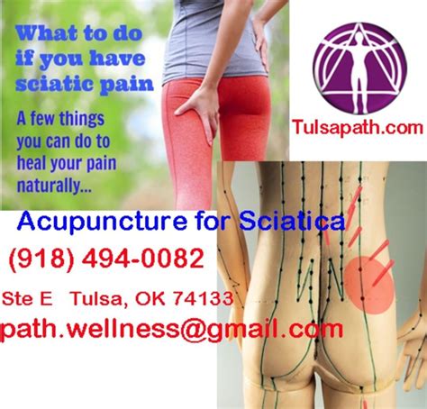 Pin On Acupuncture For Sciatica In Tulsa