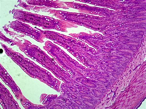 Gsc International Jejunum Mammalian Showing Plicae Circulares Section