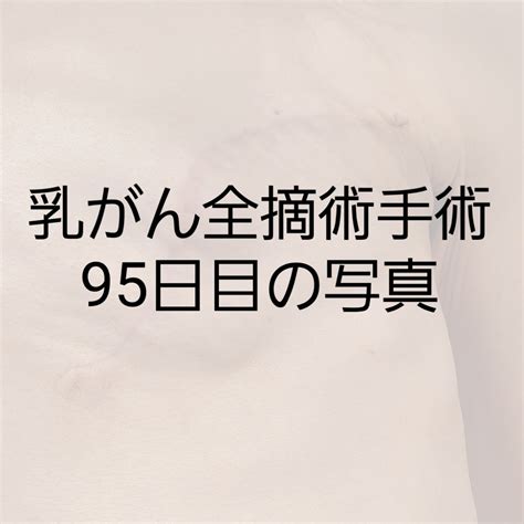 乳がん全摘術手術後95日目抗ホルモン剤57日目・年末の挨拶と傷跡写真 49歳 はじめての「がん」記録（宣告202308）