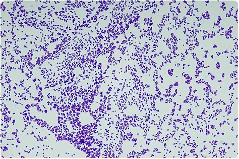 Gram Positive Bacilli