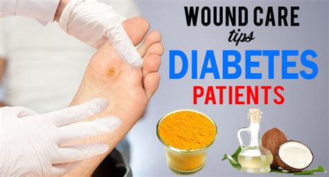 Wound Care Tips For Diabetes Patients Remedies Lore