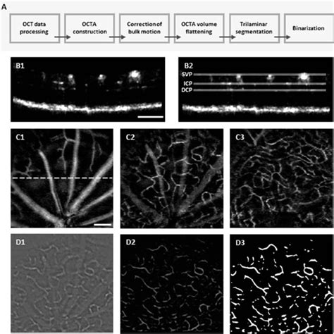 A Flow Chart Of Image Processing Procedures B Representative Octa Download Scientific