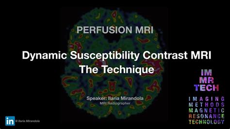 Dynamic Susceptibility Contrast MRI The Technique YouTube