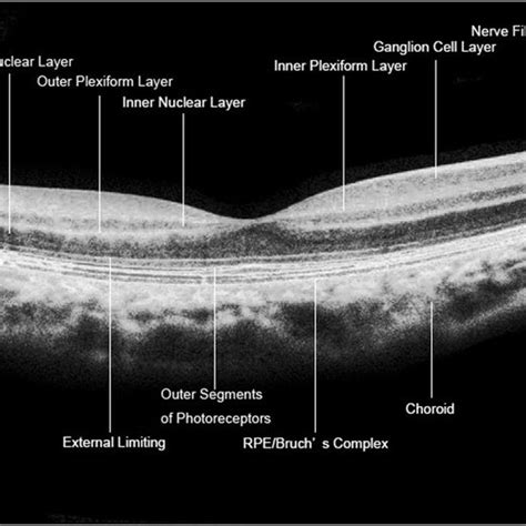 Layers Of Retina On Oct