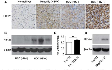 Figure 1 from Hepatitis B virus induces hypoxia inducible factor 2α