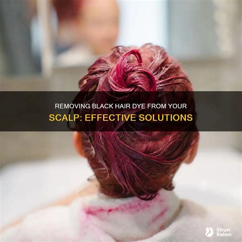 how to get hair dye off my scalp