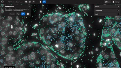 10x Genomics On Twitter Xenium Explorer’s Intuitive Lasso Tool Makes Comparing Gene Expression