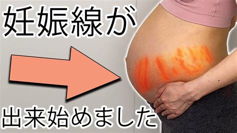 妊娠線が出現し始めました Youtube