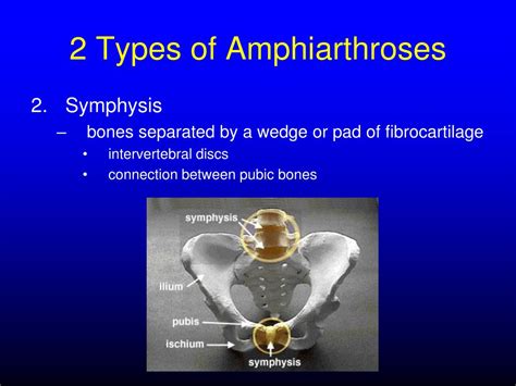 PPT - Articulations (Joints) PowerPoint Presentation, free download ...