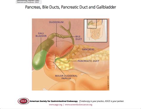 Ercp2 Launceston Gastroenterology Dr Scott Fanning