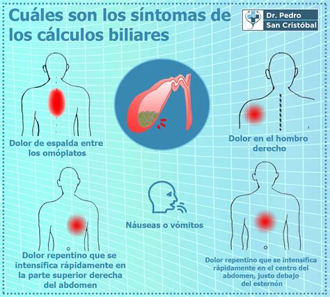 Vesícula Biliar Normodistendida Sintomas - REVOEDUCA