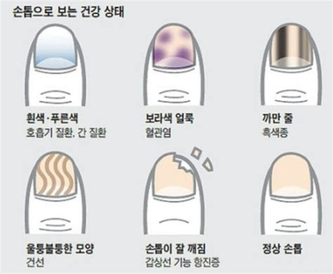 손톱으로 알아보는 건강상태 네이버 블로그