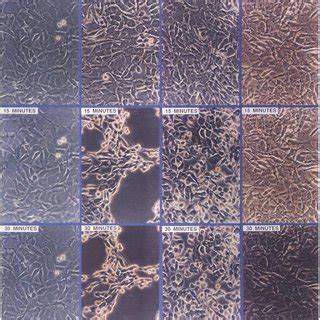 Morphological Response Of Mc T E Mouse Osteoblastic Cells To