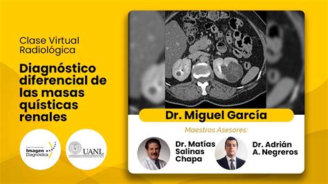 Diagnostico Diferencial De Las Masas Qu Sticas Renales Dr Miguel