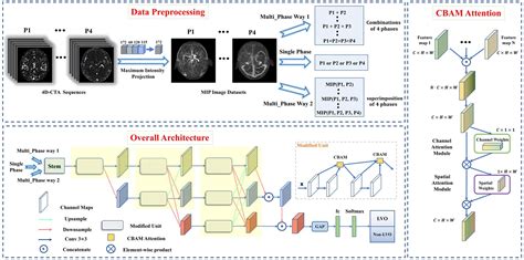 Frontiers Deep Learning Assisted Diagnosis Of Large Vessel Occlusion