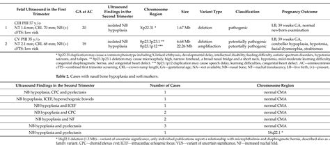 Table From Fetal Nasal Bone Hypoplasia In The Second Trimester As A