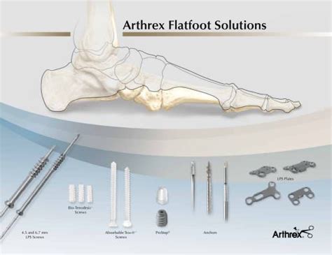 Arthrex Implant System Internalbrace Ligament Augmentation 46 Off