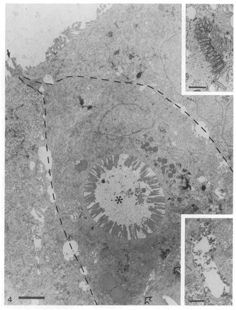 Figure 4 From Induction Of Vacuolar Apical Compartments In The Caco 2 Intestinal Epithelial Cell