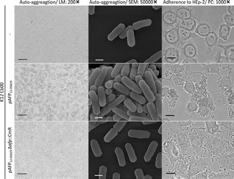 Full Article Novel Type Of Pilus Associated With A Shiga Toxigenic E