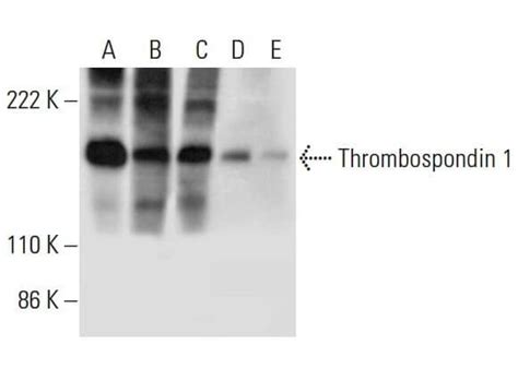 Thrombospondin 1抗体 C 9 SCBT Santa Cruz Biotechnology