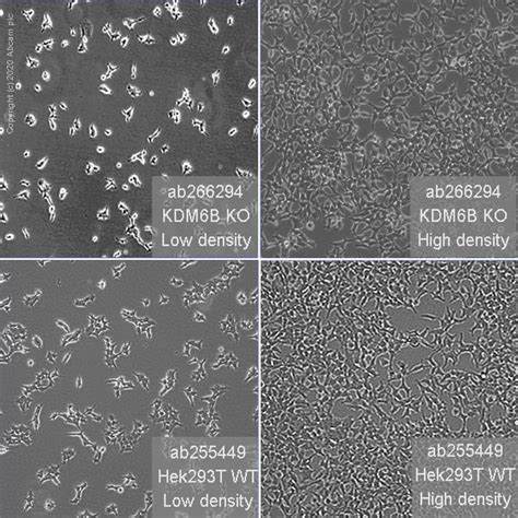 Pre Made Human Kdm B Jmjd Knockout Hek T Cell Line Ab Abcam