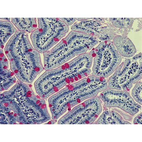 PAS (Periodic Acid-Schiff)-Harris Hematoxylin Histology Stain