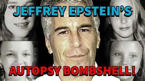 Jeffrey Epstein Autopsy Results And The Inconsistencies Full Breakdown Youtube