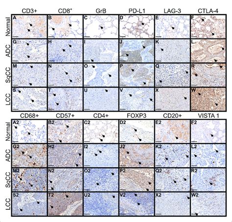 Microphotographs Of Representative Examples Of The 12 Immune Markers