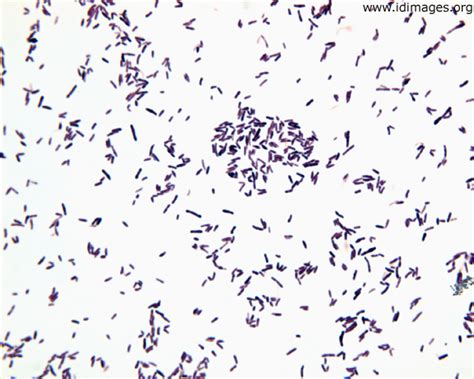 Throat Culture Gram Stain