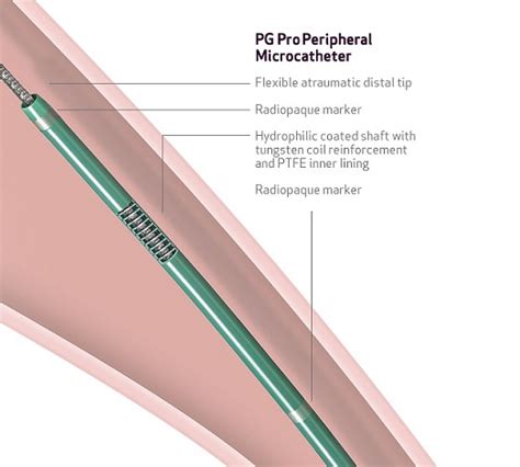 PG Pro Peripheral Microcatheter